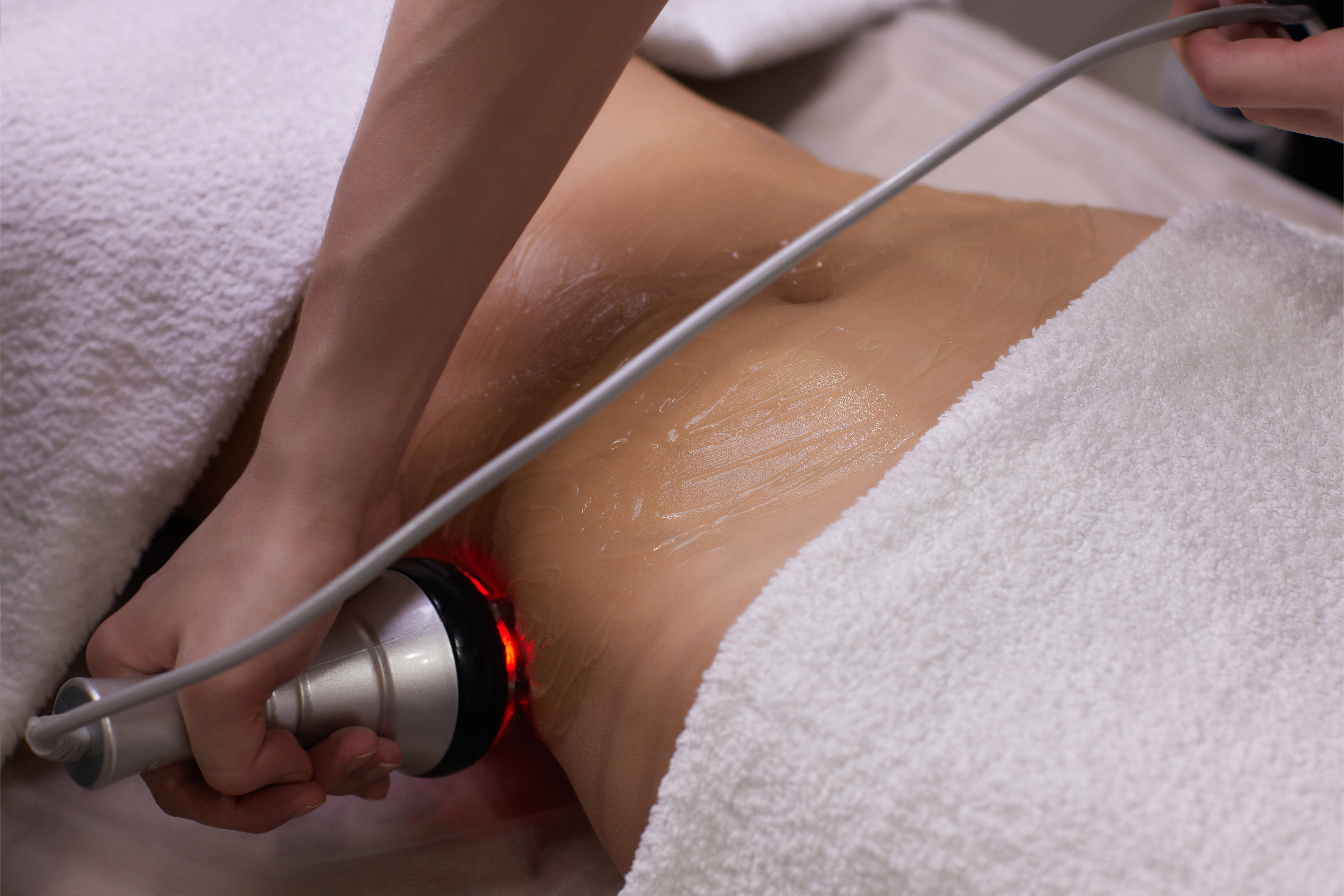 CAVITATION